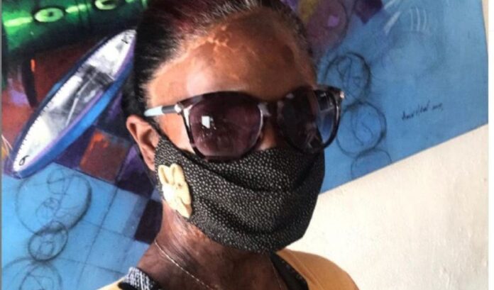 «Influencer» busca justicia e inspirar otras víctimas