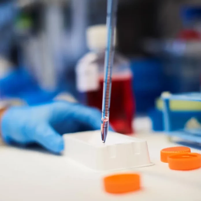 Identifican cómo superar la resistencia al tratamiento en un tipo de leucemia