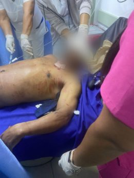 Video Autor del triple crimen de Bonao La que