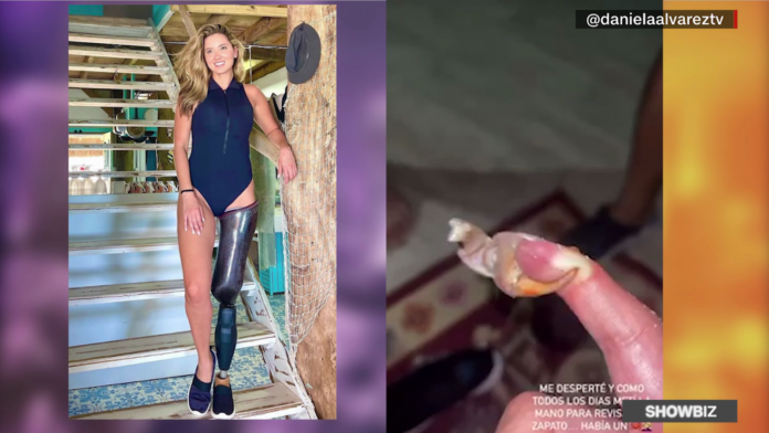 Daniela Álvarez sufre la dura mordedura de un cangrejo