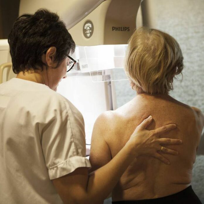 La terapia hormonal sumada al fármaco ribociclib reduce la recaída del cáncer de mama