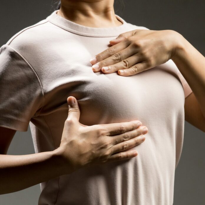 Optimizar la terapia del cáncer de mama permite evitar la quimio a un 30 % de pacientes