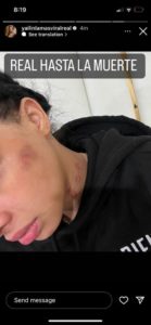 1688708351 24 Yailin revela Anuel AA la agredio fisicamente durante su embarazo