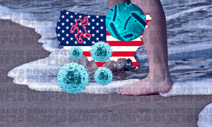 Florida reporta 5 muertes y 26 infectados en lo que va de año por la bacteria «come-carne»