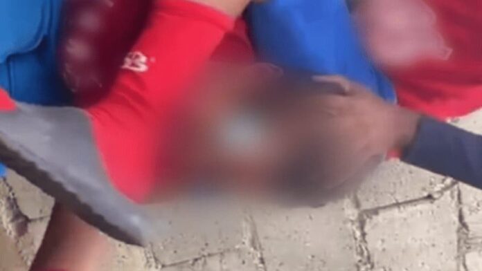Autoridades asumen caso de menor golpeado y torturado por otros