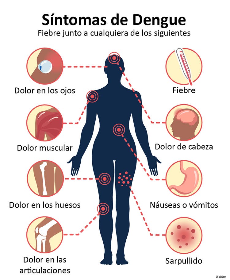 Dengue ¿Cual es el costo de las plaquetas por aferesis