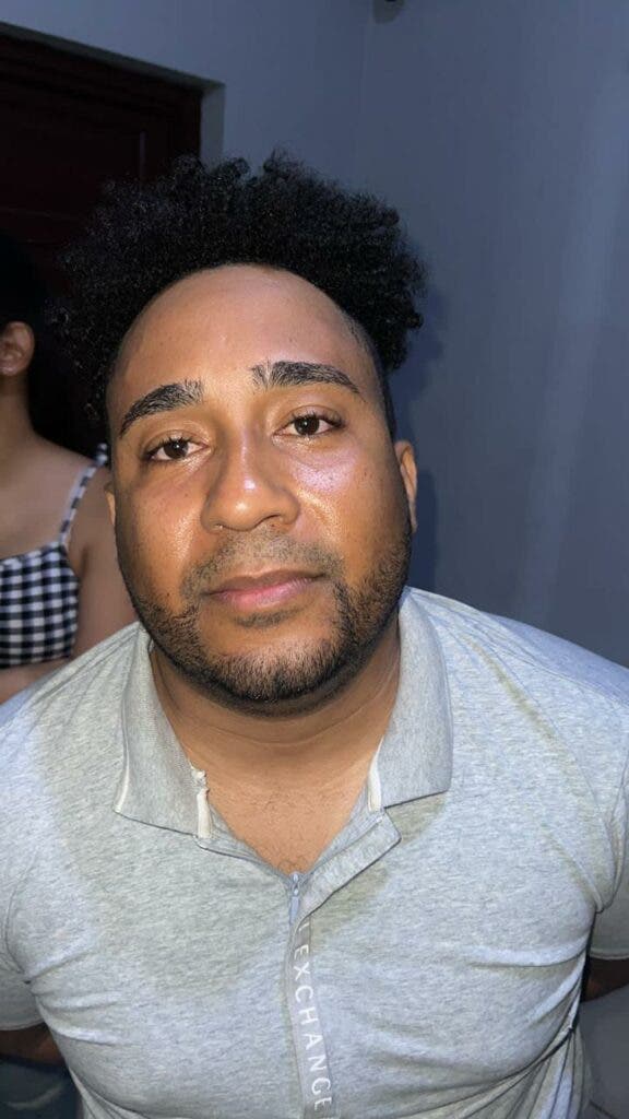 Hombre agredio a su padre con un objeto contundente