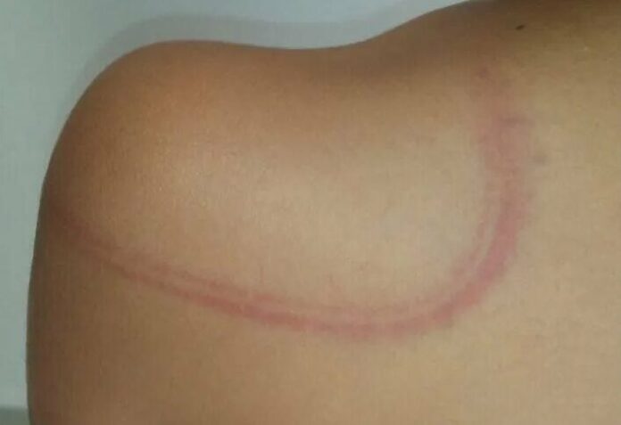 ¡En presencia de su madre! “Tía” azotaba a niño con cables eléctricos