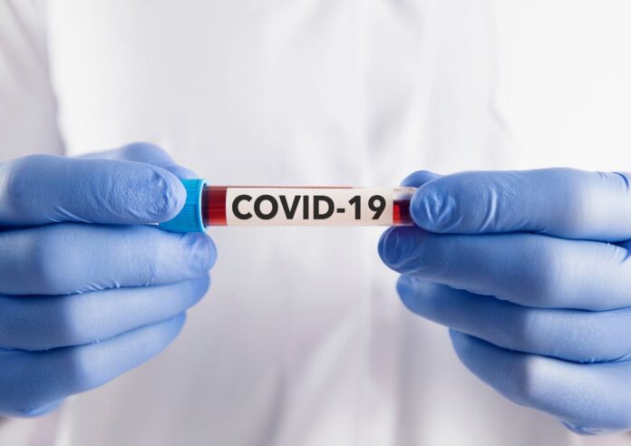 Salud Pública reporta 116 casos activos de covid; 76 nuevos contagios