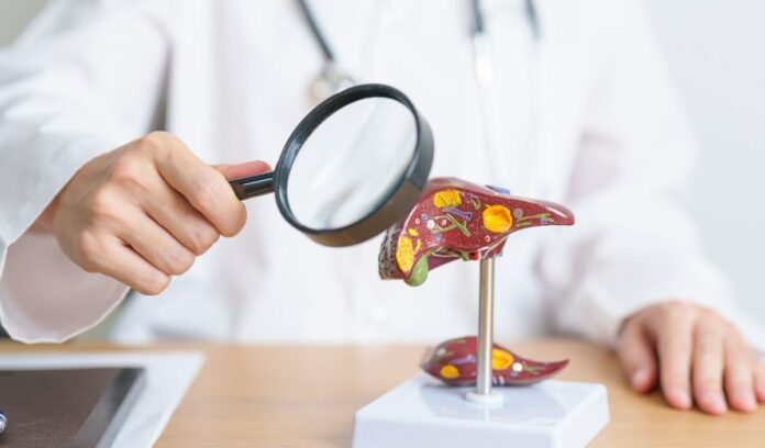 Se prevé aumento de la Enfermedad Hepática Metabólica debido incremento obesidad y la diabetes