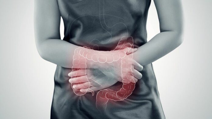 ONG llama a atender falta de medicamentos para cáncer colorrectal en México