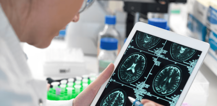 Descubren el ‘punto caliente’ del cerebro donde se produce el envejecimiento