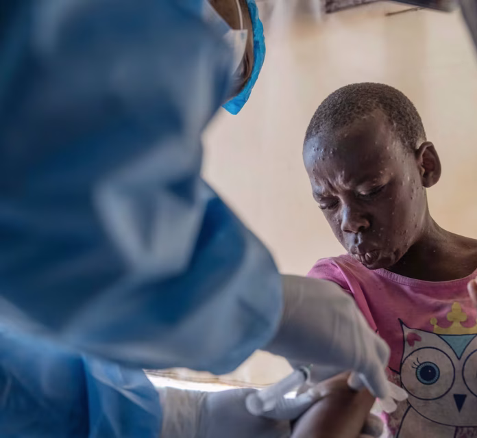 Oxfam avisa de alza de casos de mpox y cólera en RDC agravada por falta de ayuda de EE.UU.