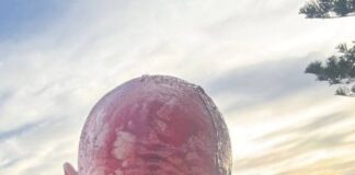 Escalofriante imagen del líder de la comunidad judía tras resultar herido en el tiroteo masivo de Australia