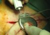 ¿Médicos matasanos? Alta mortalidad y morbilidad. Red ilegal involucra médicos y centros capta pacientes graves