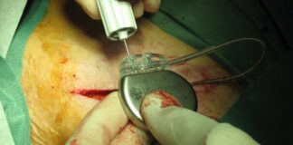 ¿Médicos matasanos? Alta mortalidad y morbilidad. Red ilegal involucra médicos y centros capta pacientes graves