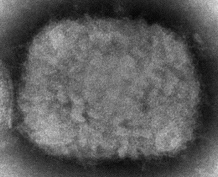 Estados Unidos reporta primer caso de viruela símica en Massachusetts￼