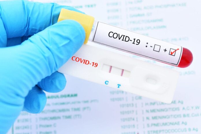 Reportan 1,317 nuevos contagios Covid-19