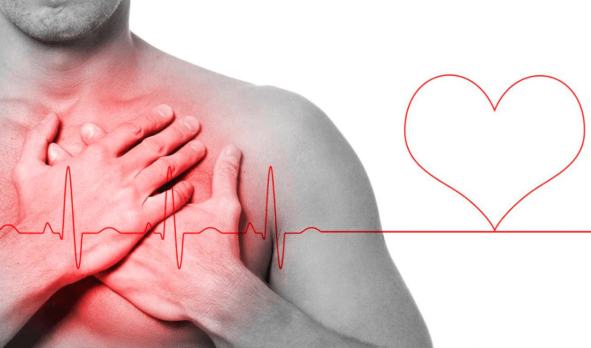 El síndrome de corazón roto puede confundirse con un infarto