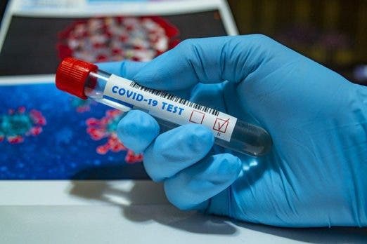 Salud Pública notifica 155 casos nuevos de covid-19