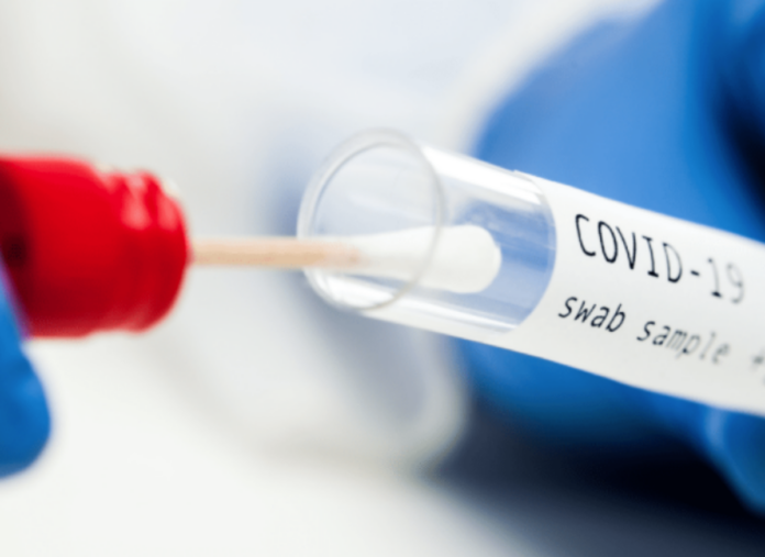 El Ministerio de Salud reporta 20 casos de coronavirus en las últimas 24 horas
