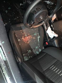 Familiares de joven herida por limpiavidrios concentrados en su salud