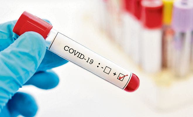 SP notifica hay siete casos de covid-19; y 206 afectados