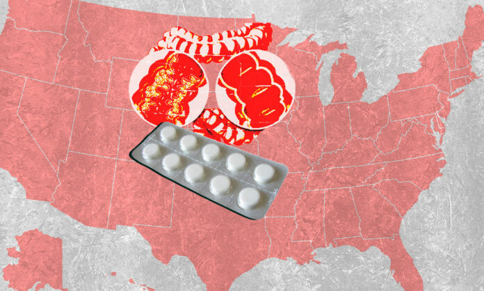 Estados Unidos aprueba el uso del primer medicamento oral contra la enfermedad de Crohn
