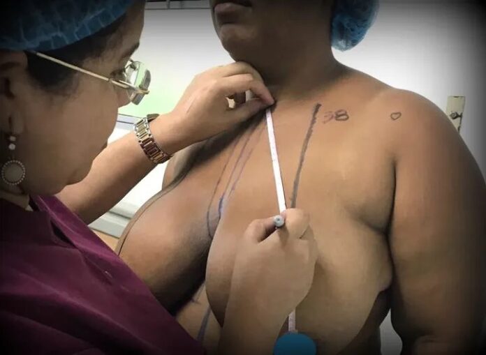 Cirujano Vargas Almonte aboga por que las ARS cubran cirugías de reducción mamaria