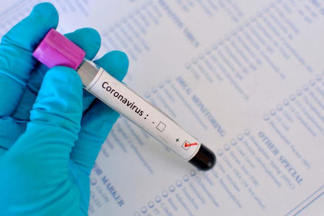 Salud Pública notifica 14 casos nuevos de COVID-19 en la última semana