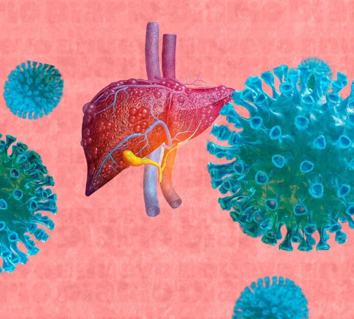 Virus de hepatitis son la 7ma causa principal de muerte en el mundo, según especialista