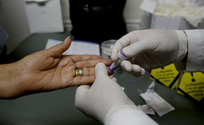 Día Mundial de la Hepatitis: podría ser más letal que la malaria, la tuberculosis y el sida en 2040