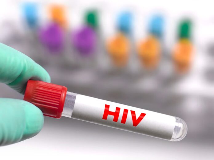 Paciente de Ginebra: sexto caso de posible curación de VIH tras trasplante de médula