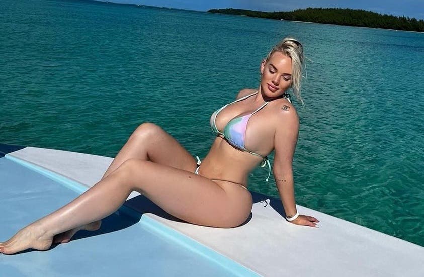 1693425548 362 Amputan pierna de modelo tras infectarse con una bacteria come