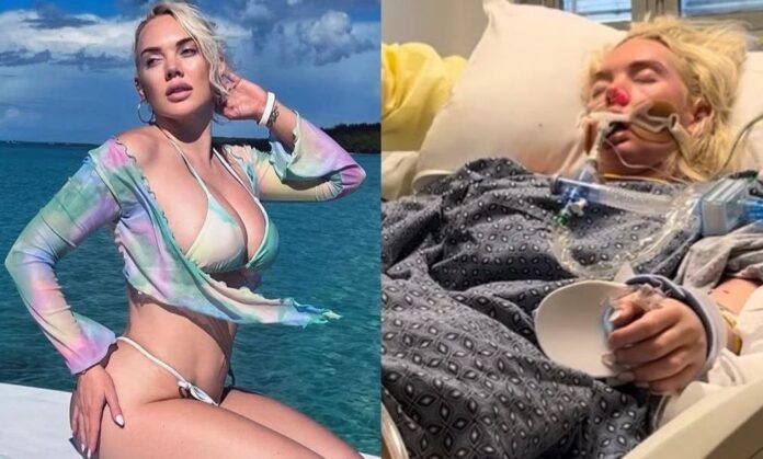 Amputan pierna de modelo tras infectarse con una bacteria come carne