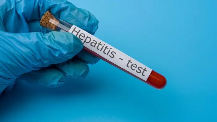 Aumentan los casos de hepatitis B en Nueva York