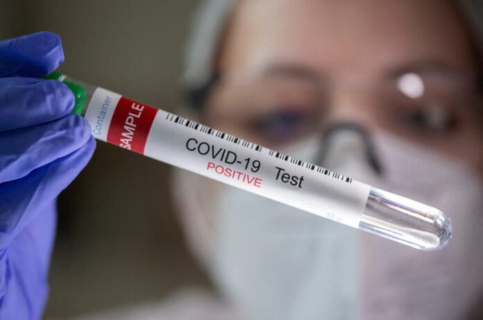 Salud notifica hay 24 contagios Covid-19; y 66 personas activas