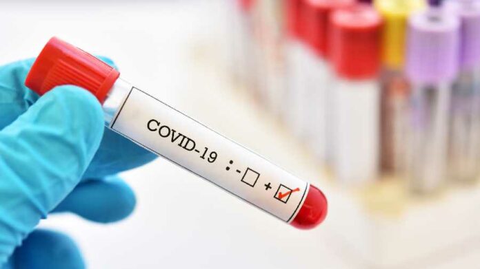 Se registran 24 nuevos casos de COVID-19 en RD