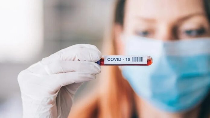 Se registra 109 nuevos contagios de covid, sin hospitalizaciones