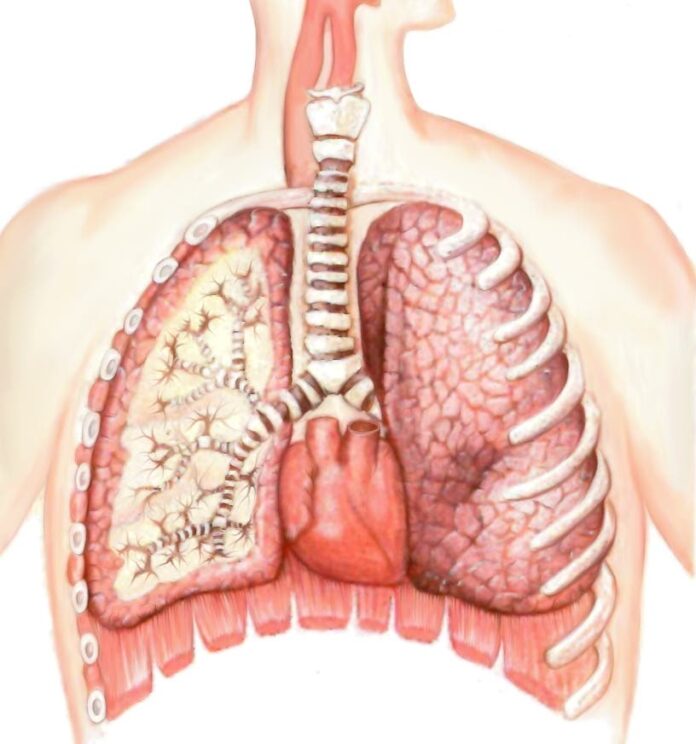 Médica advierte sobre hipertensión pulmonar