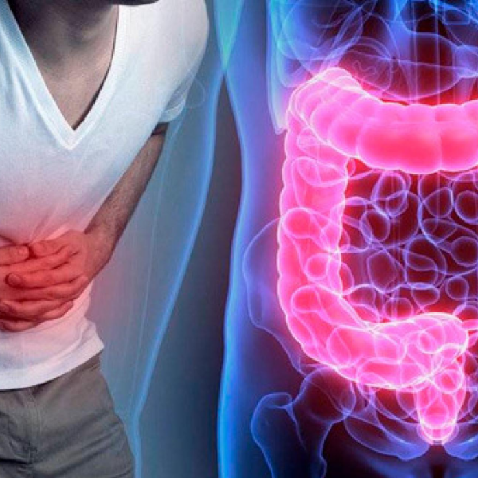 Cuatro claves para mantener el intestino sano y prevenir enfermedades inflamatorias, según experto