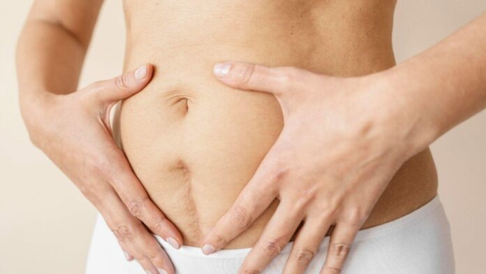 Especialista: 2 de cada 3 mujeres sufren diástasis de recto abdominal tras el parto