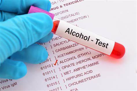 Prueba de alcoholemia, en caso Aida Nicole 