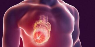 Disección aórtica: ¿qué es la enfermedad que hizo ‘estallar’ el corazón de Lindsey Graham?